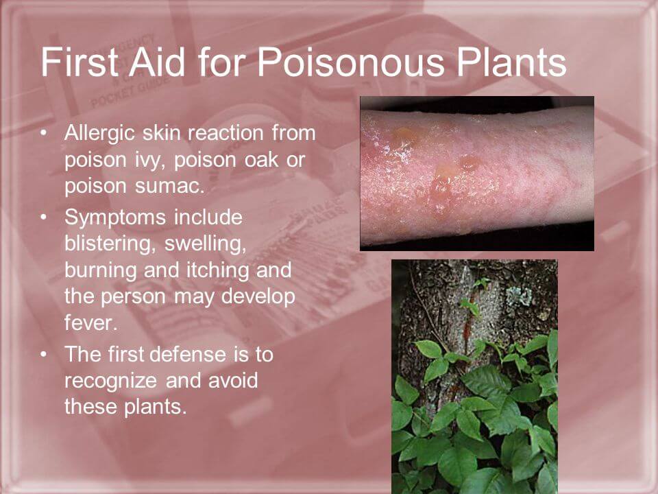 First-Aid-For-Poisonous-Plants